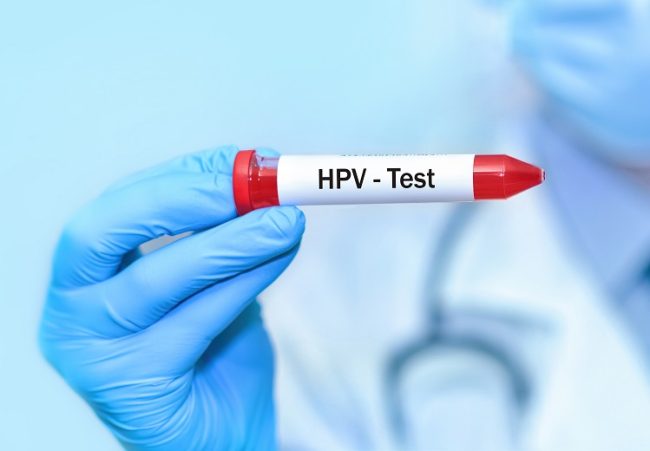 hpv testen pap test auffällig