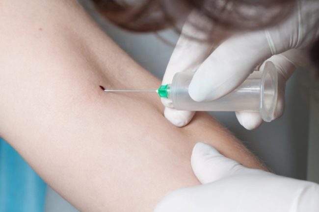 hormone bestimmen labor